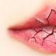 Pourquoi les lèvres se caprit au sang