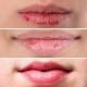 Neden dudaklar çatlıyor: Nedenleri ve tedavi